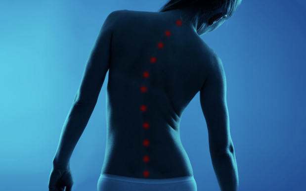 Spatele unei femei cu coloana vertebrala marcata prin puncte rosii.